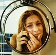 ουλές ακμής