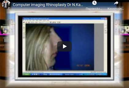 АНЕСТЕЗИЯ В ПЛАСТИЧЕСКОЙ ХИРУРГИИ